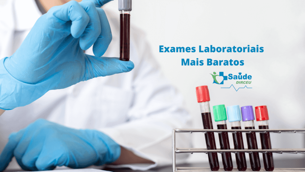 Exame-Laboratorio-popular-teresina-saude dirceu