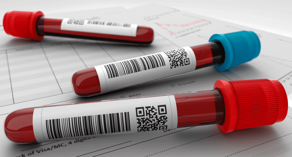 exames-de-sangue-laboratoriais-preço-popular-mais-barato-teresina