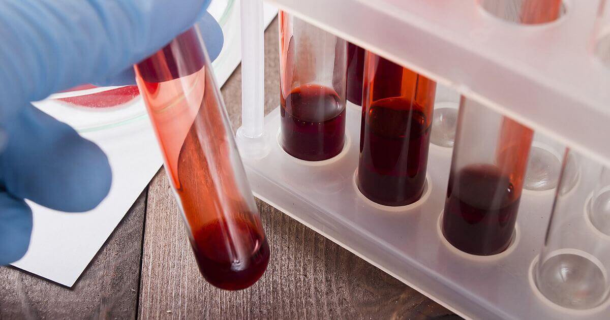 Laboratório Exames Laboratoriais Populares em Teresina