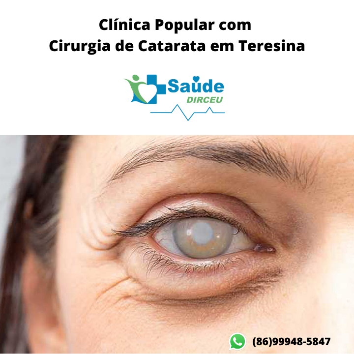 clinica-popular-com-cirurgia-de catarata-teresina