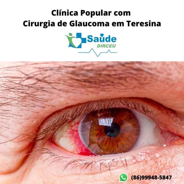 clinica-popular-com-cirurgia-de glaucoma-teresina