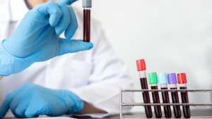 Exames de Laboratório Mais Baratos em Teresina