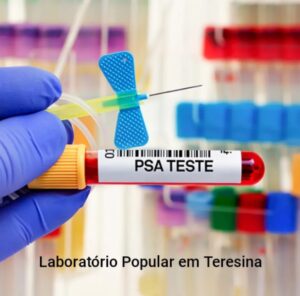 Laboratório Popular Barato em Teresina